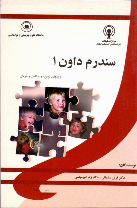 سندروم داون 1